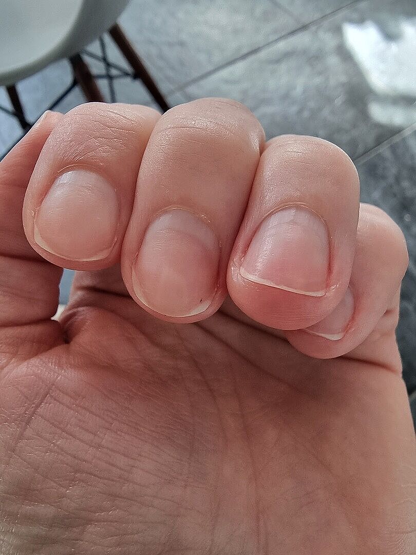 Rettet meine Nägel nach Nagellackpause