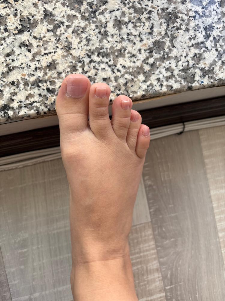 Süße Füße im Sommer