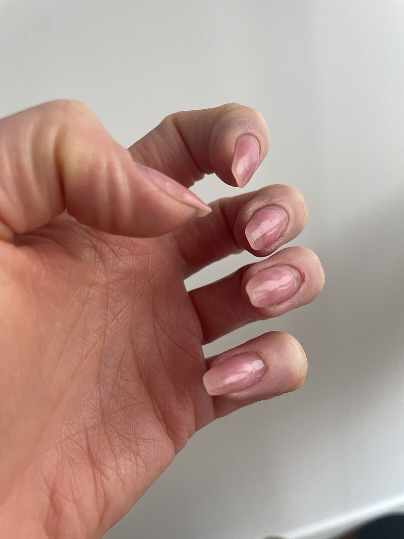 Nagelretter