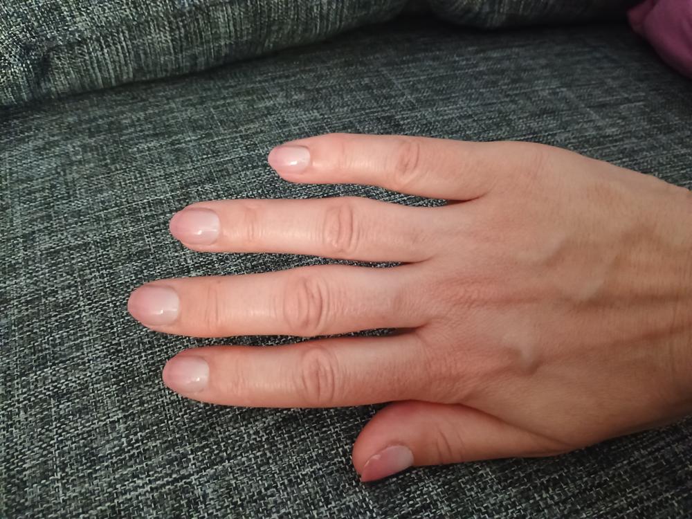 Nägel sehen gesünder aus