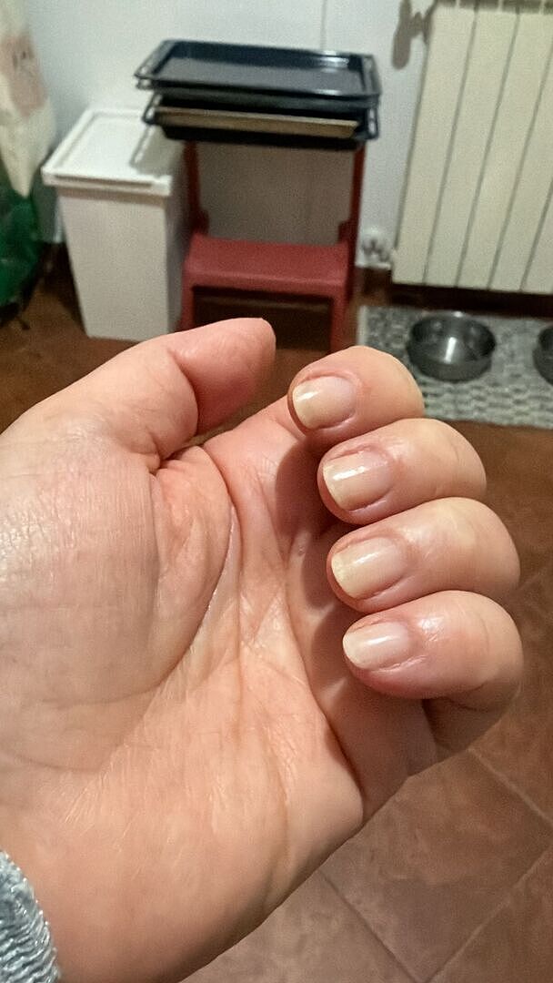 Rettet meine Nägel nach Gel