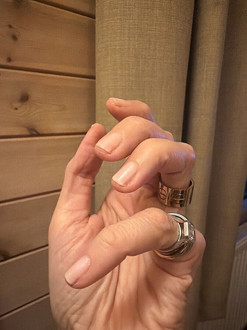 Rettet gelbe Nägel optisch