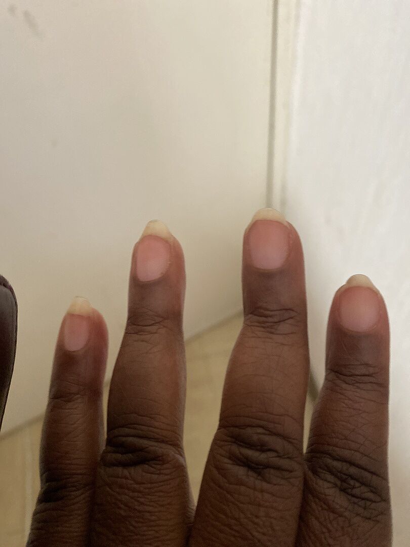 Gute Kombination für die Nagelpflege