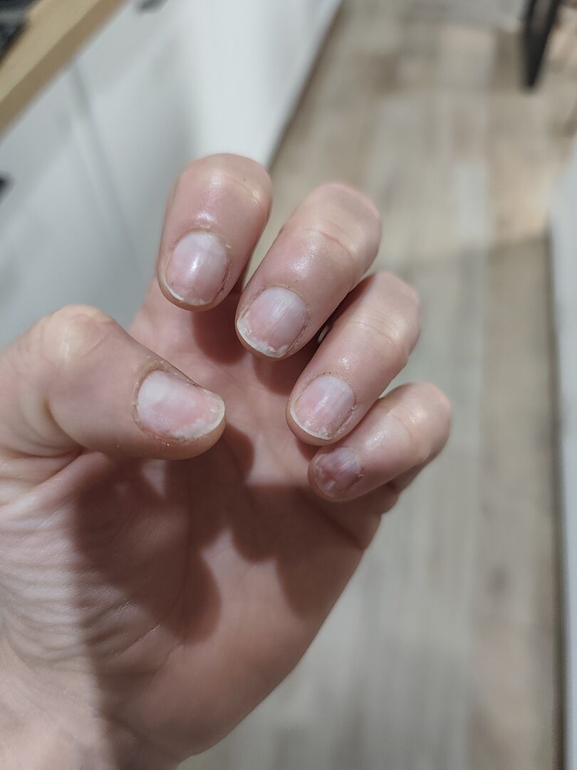 Rettung für meine Nägel